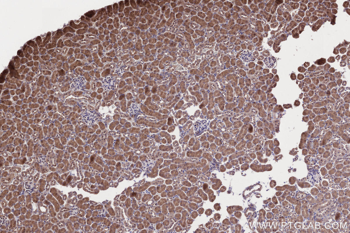 Immunohistochemical analysis of paraffin-embedded mouse kidney tissue slide using KHC2688 (PAPD5 IHC Kit).