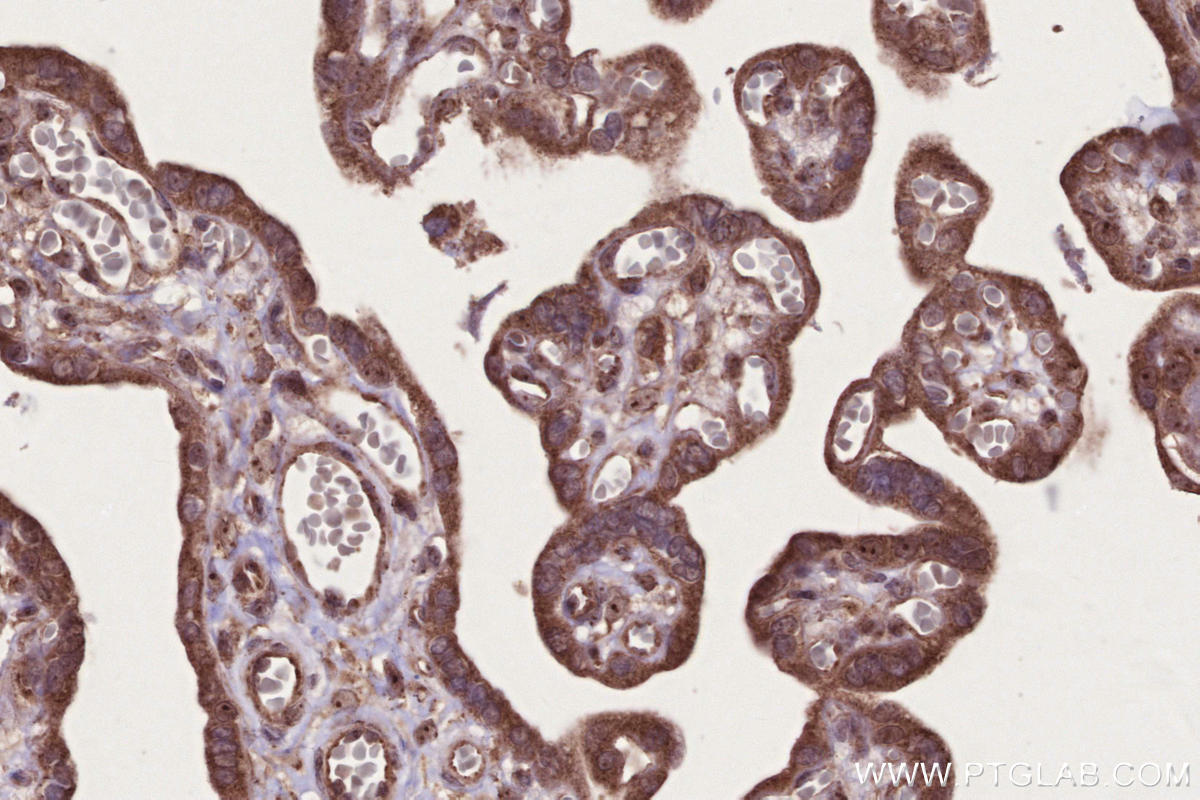 Immunohistochemical analysis of paraffin-embedded human placenta tissue slide using KHC2688 (PAPD5 IHC Kit).