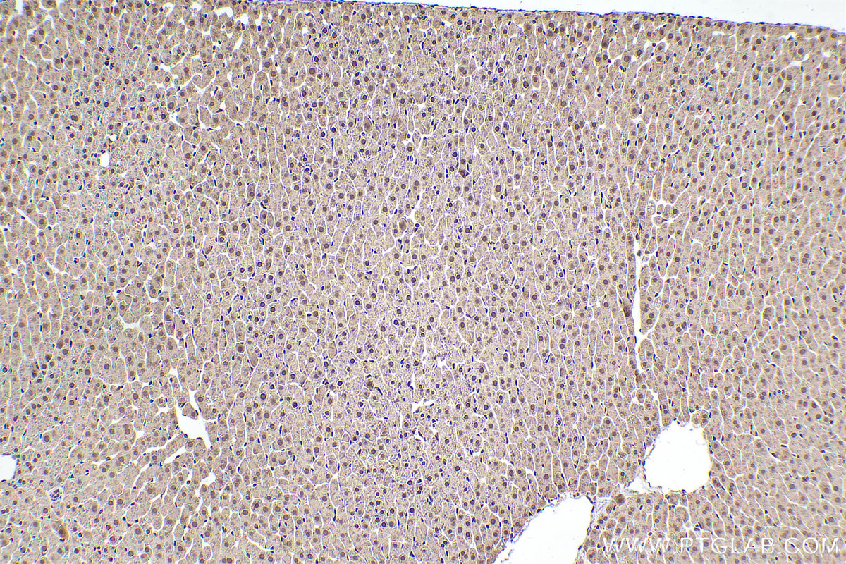 Immunohistochemical analysis of paraffin-embedded rat liver tissue slide using KHC2486 (PCBP2 IHC Kit).