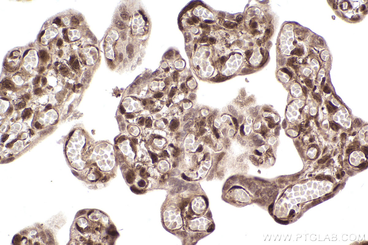 Immunohistochemical analysis of paraffin-embedded human placenta tissue slide using KHC2486 (PCBP2 IHC Kit).