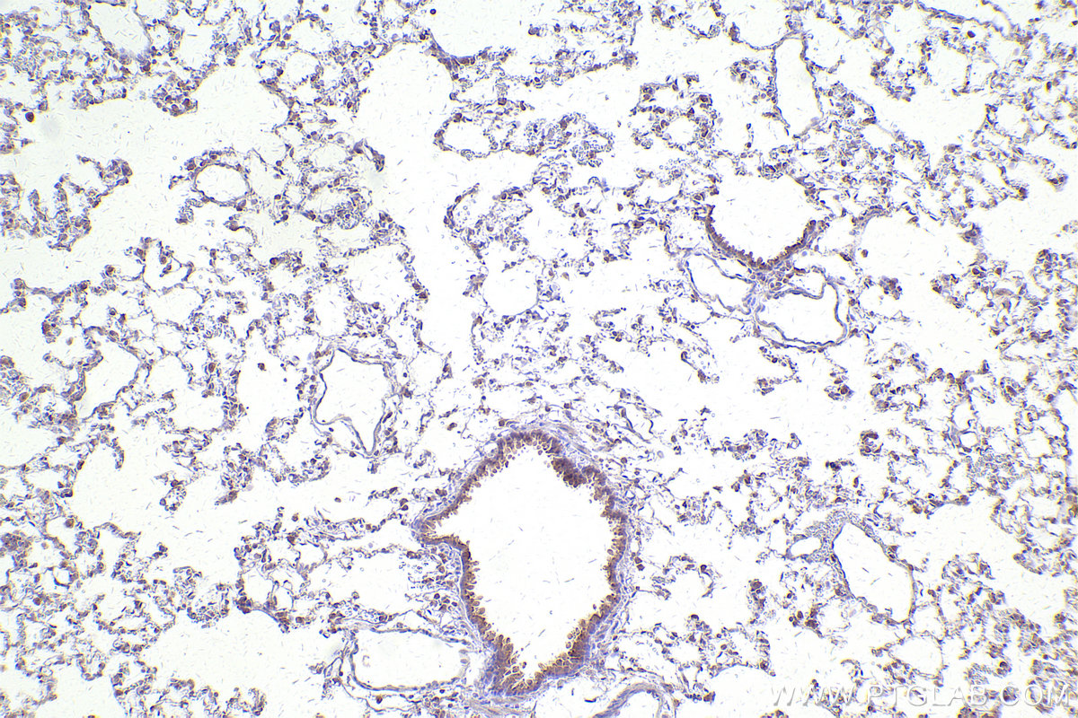 Immunohistochemical analysis of paraffin-embedded rat lung tissue slide using KHC2518 (PCM1 IHC Kit).