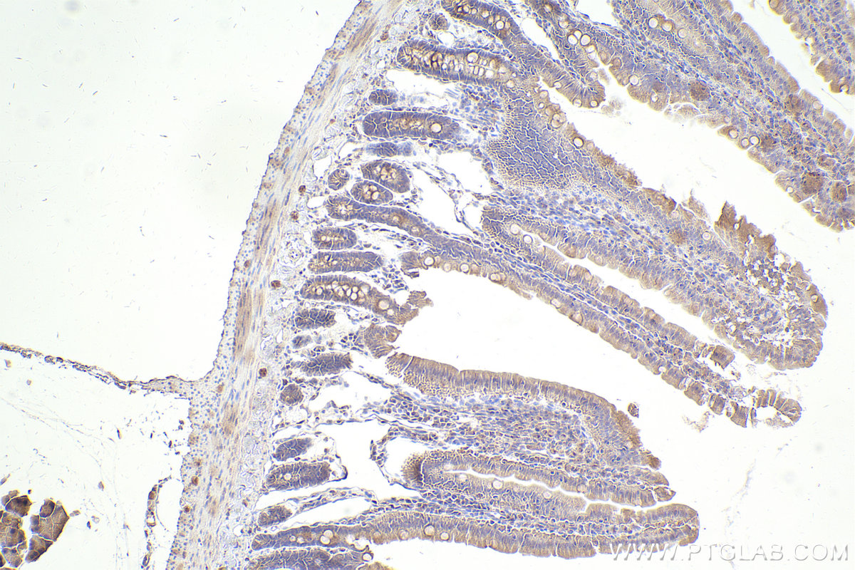 Immunohistochemical analysis of paraffin-embedded rat small intestine tissue slide using KHC2518 (PCM1 IHC Kit).