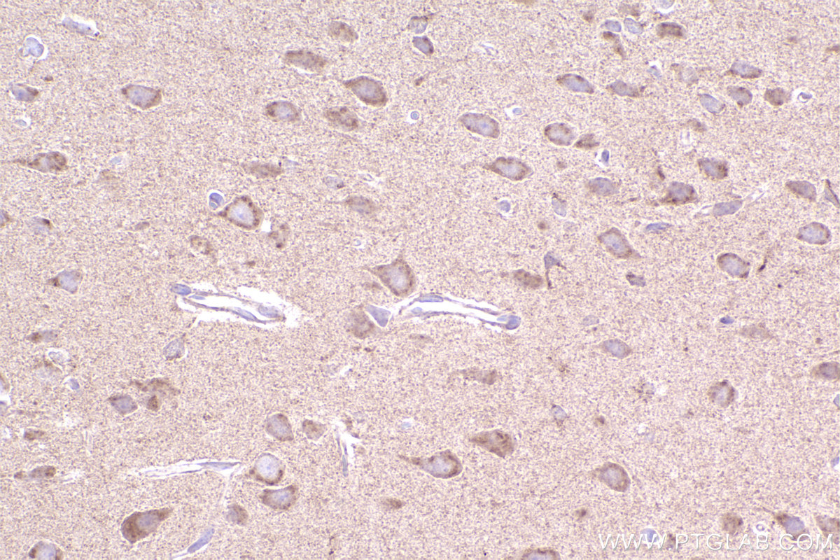 Immunohistochemical analysis of paraffin-embedded rat brain tissue slide using KHC2398 (PCTAIRE3 IHC Kit).