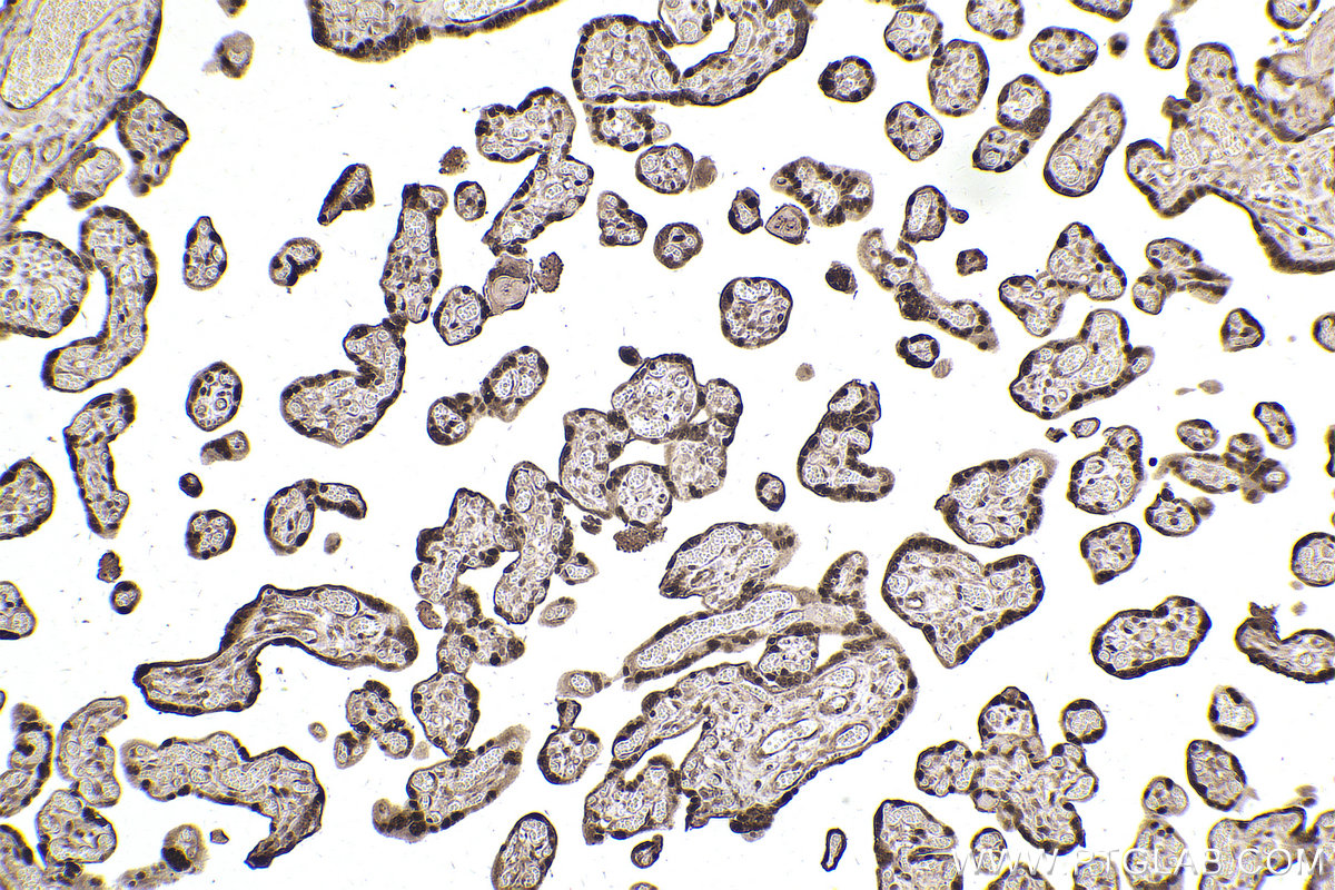 Immunohistochemical analysis of paraffin-embedded human placenta tissue slide using KHC2532 (PDCD4 IHC Kit).