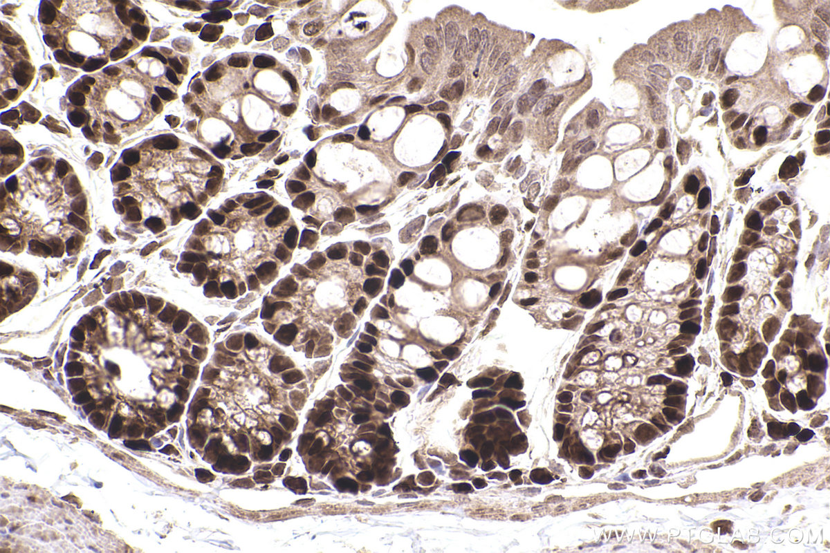 Immunohistochemical analysis of paraffin-embedded mouse colon tissue slide using KHC2532 (PDCD4 IHC Kit).