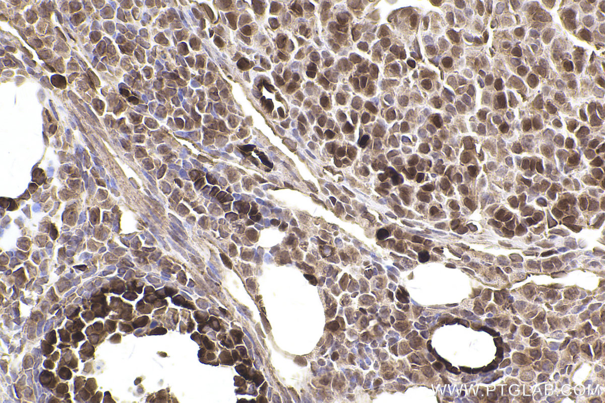 Immunohistochemical analysis of paraffin-embedded mouse ovary tissue slide using KHC2532 (PDCD4 IHC Kit).