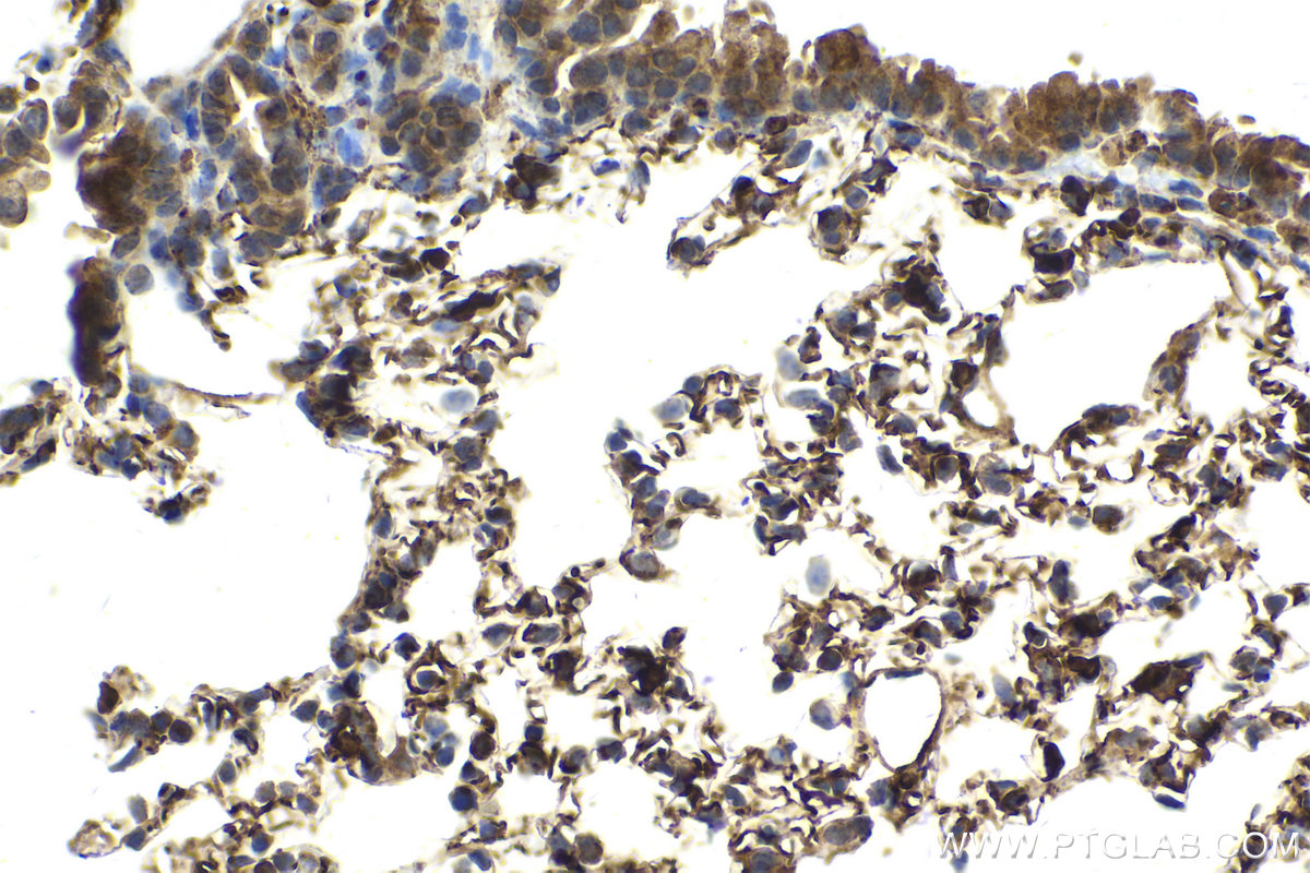 Immunohistochemical analysis of paraffin-embedded mouse lung tissue slide using KHC2126 (PDE5A IHC Kit).