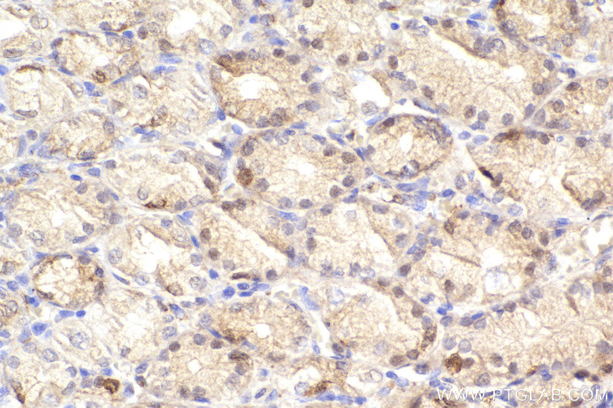 Immunohistochemical analysis of paraffin-embedded human stomach tissue slide using KHC2297 (PDLIM4 IHC Kit).