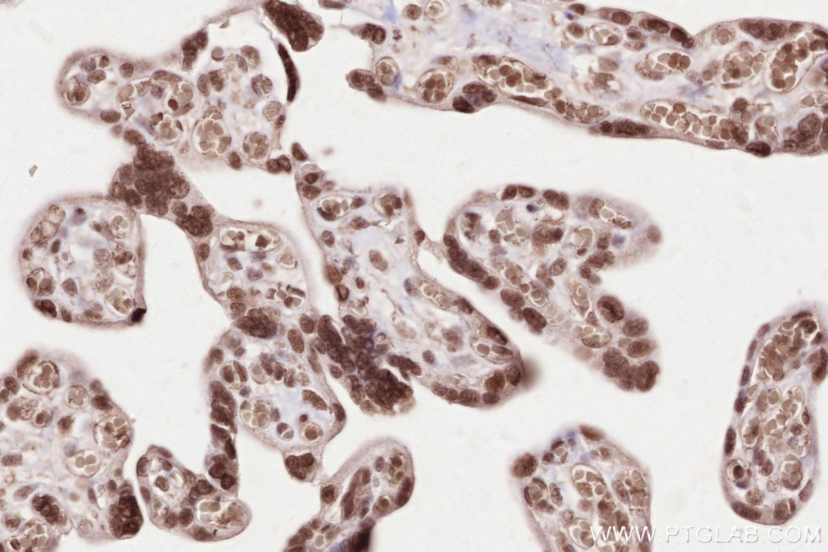 Immunohistochemical analysis of paraffin-embedded human placenta tissue slide using KHC2525 (PDS5A IHC Kit).