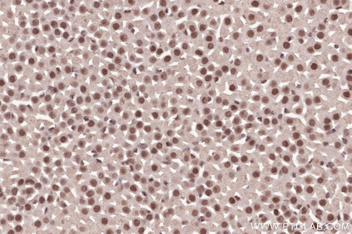 Immunohistochemical analysis of paraffin-embedded mouse adrenal gland tissue slide using KHC2525 (PDS5A IHC Kit).