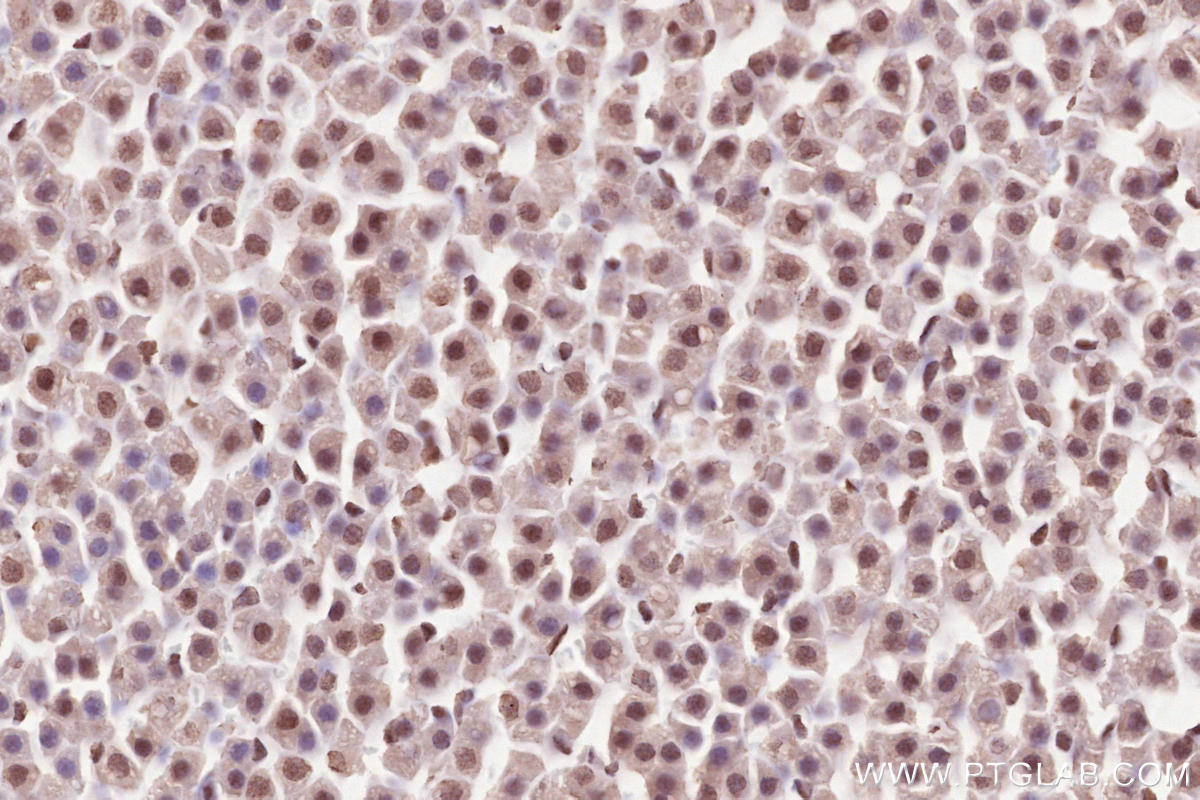 Immunohistochemical analysis of paraffin-embedded rat adrenal gland tissue slide using KHC2525 (PDS5A IHC Kit).