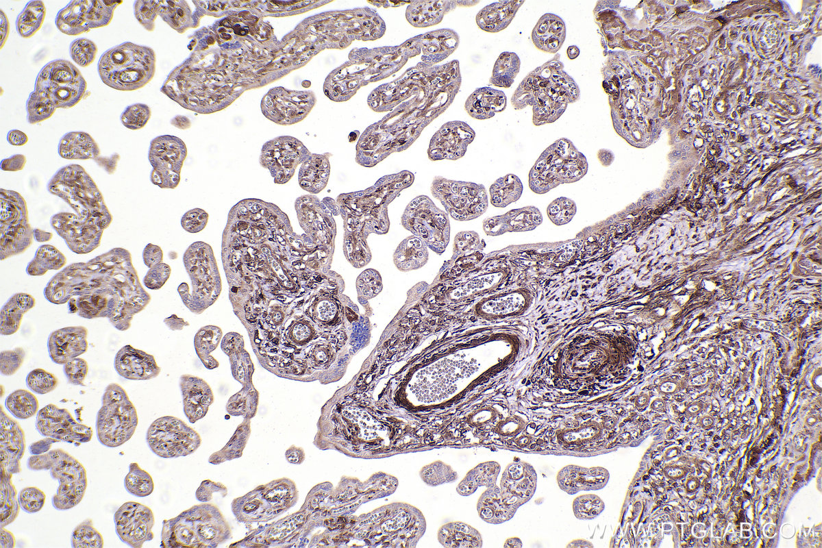 Immunohistochemical analysis of paraffin-embedded human placenta tissue slide using KHC2385 (PFKP IHC Kit).