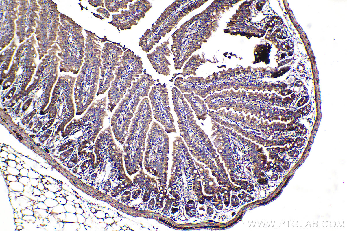 Immunohistochemical analysis of paraffin-embedded mouse small intestine tissue slide using KHC2385 (PFKP IHC Kit).