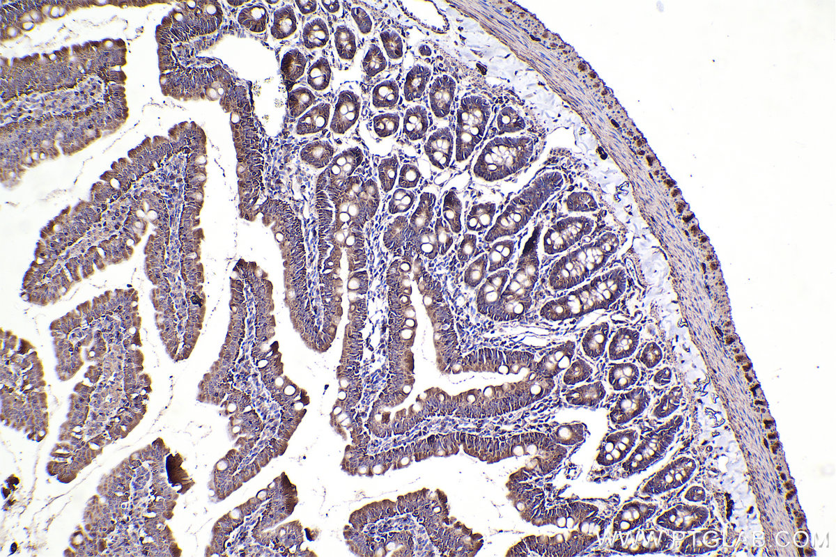 Immunohistochemical analysis of paraffin-embedded rat small intestine tissue slide using KHC2385 (PFKP IHC Kit).