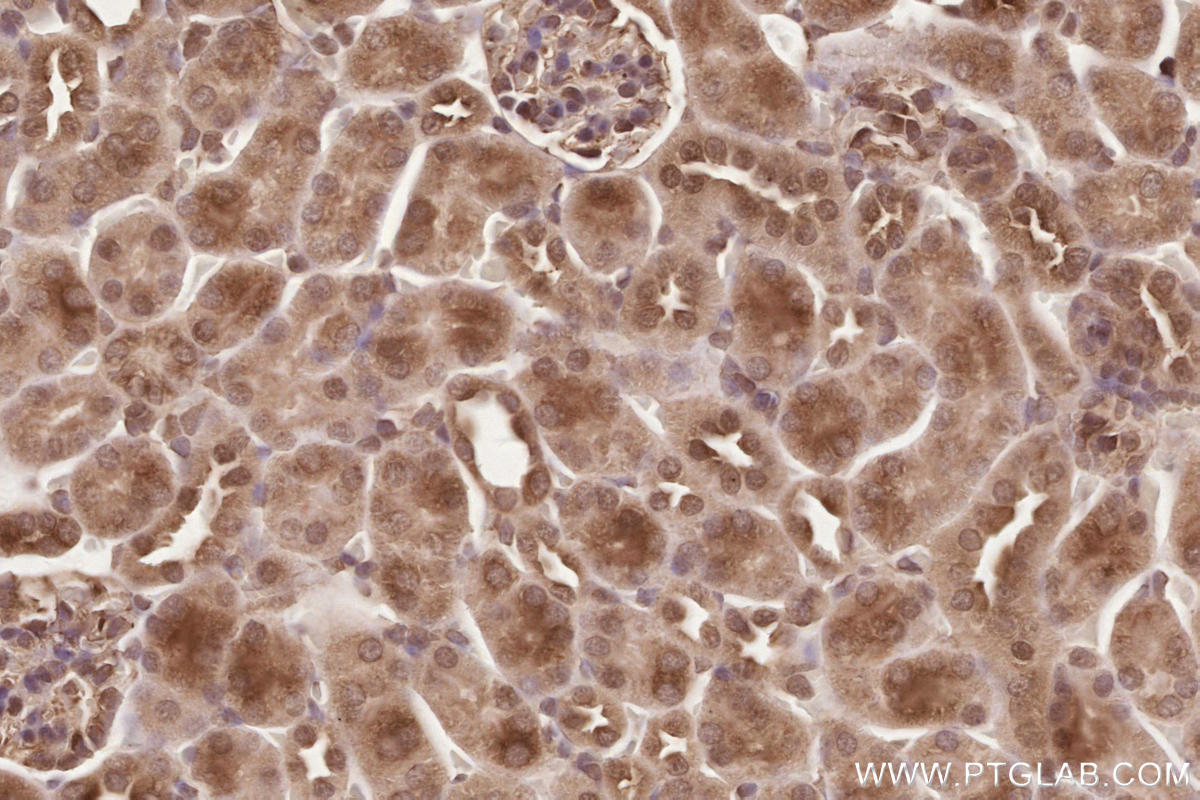 Immunohistochemical analysis of paraffin-embedded mouse kidney tissue slide using KHC2579 (PHF17 IHC Kit).