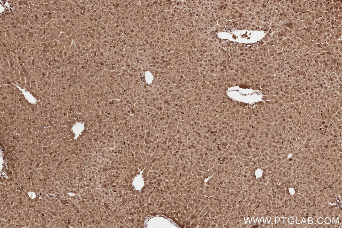 Immunohistochemical analysis of paraffin-embedded mouse liver tissue slide using KHC2579 (PHF17 IHC Kit).