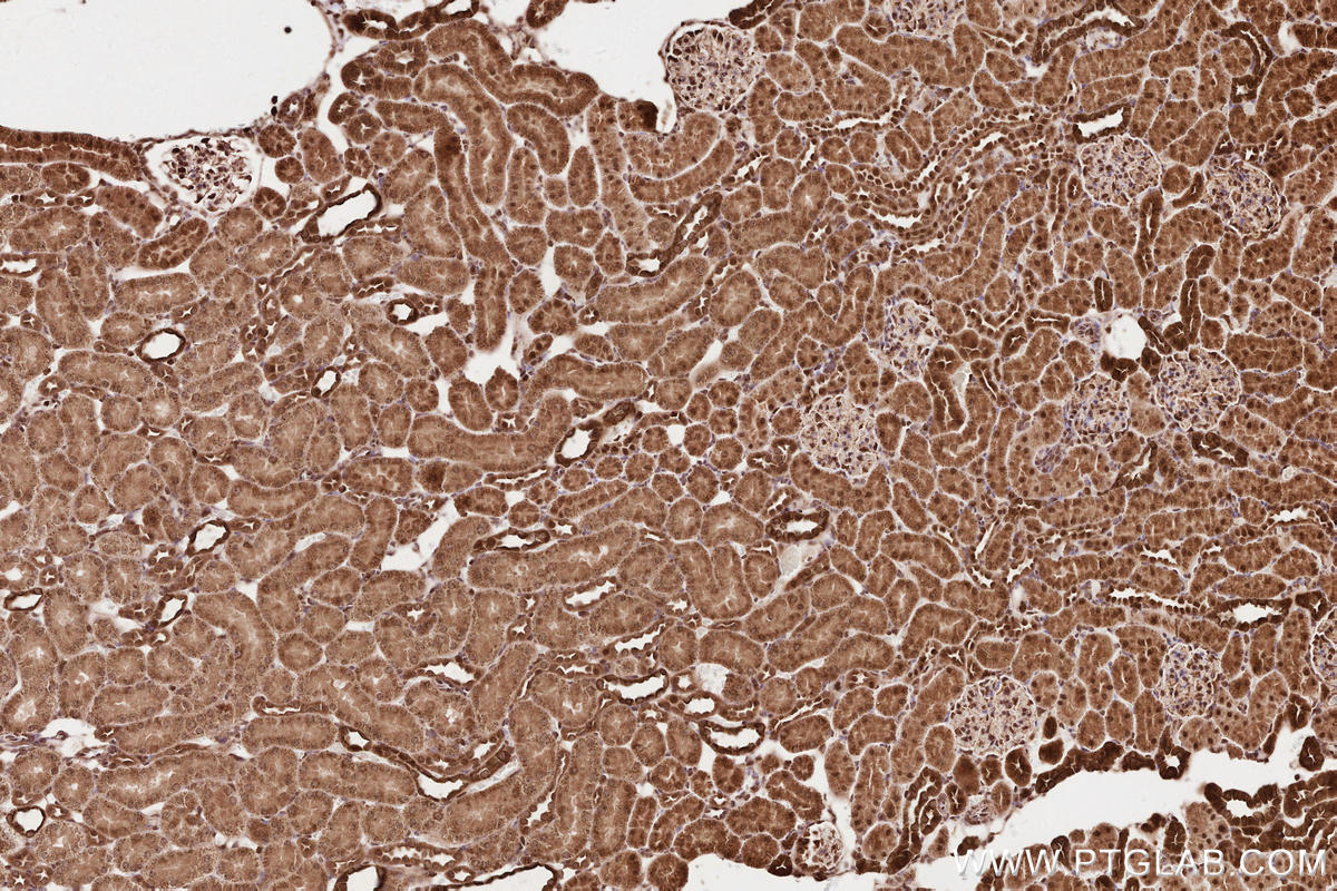 Immunohistochemical analysis of paraffin-embedded rat kidney tissue slide using KHC2579 (PHF17 IHC Kit).