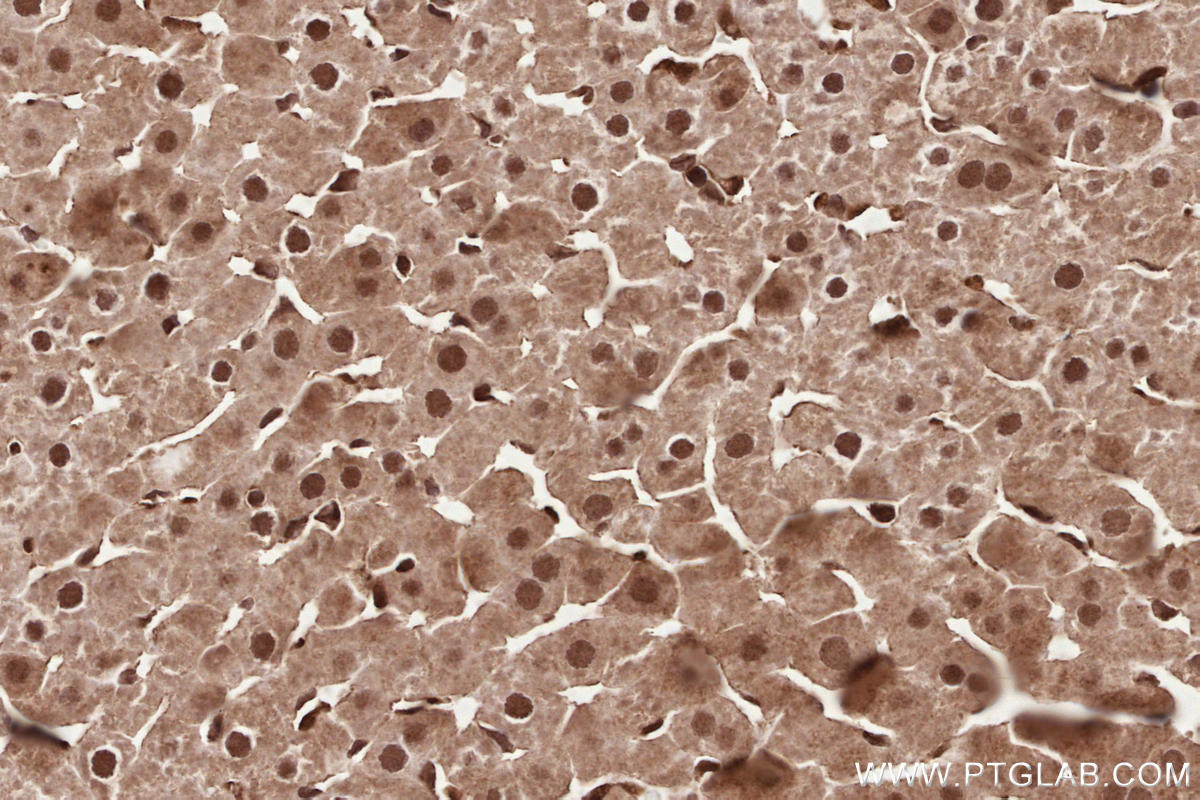 Immunohistochemical analysis of paraffin-embedded rat liver tissue slide using KHC2579 (PHF17 IHC Kit).