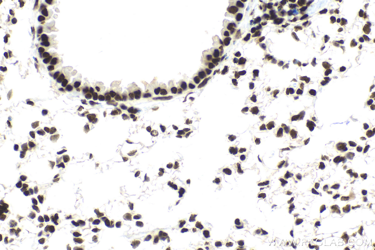 Immunohistochemical analysis of paraffin-embedded mouse lung tissue slide using KHC2122 (PIAS1 IHC Kit).