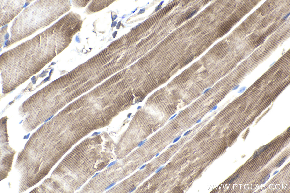 Immunohistochemical analysis of paraffin-embedded mouse skeletal muscle tissue slide using KHC2012 (PIN4 IHC Kit).