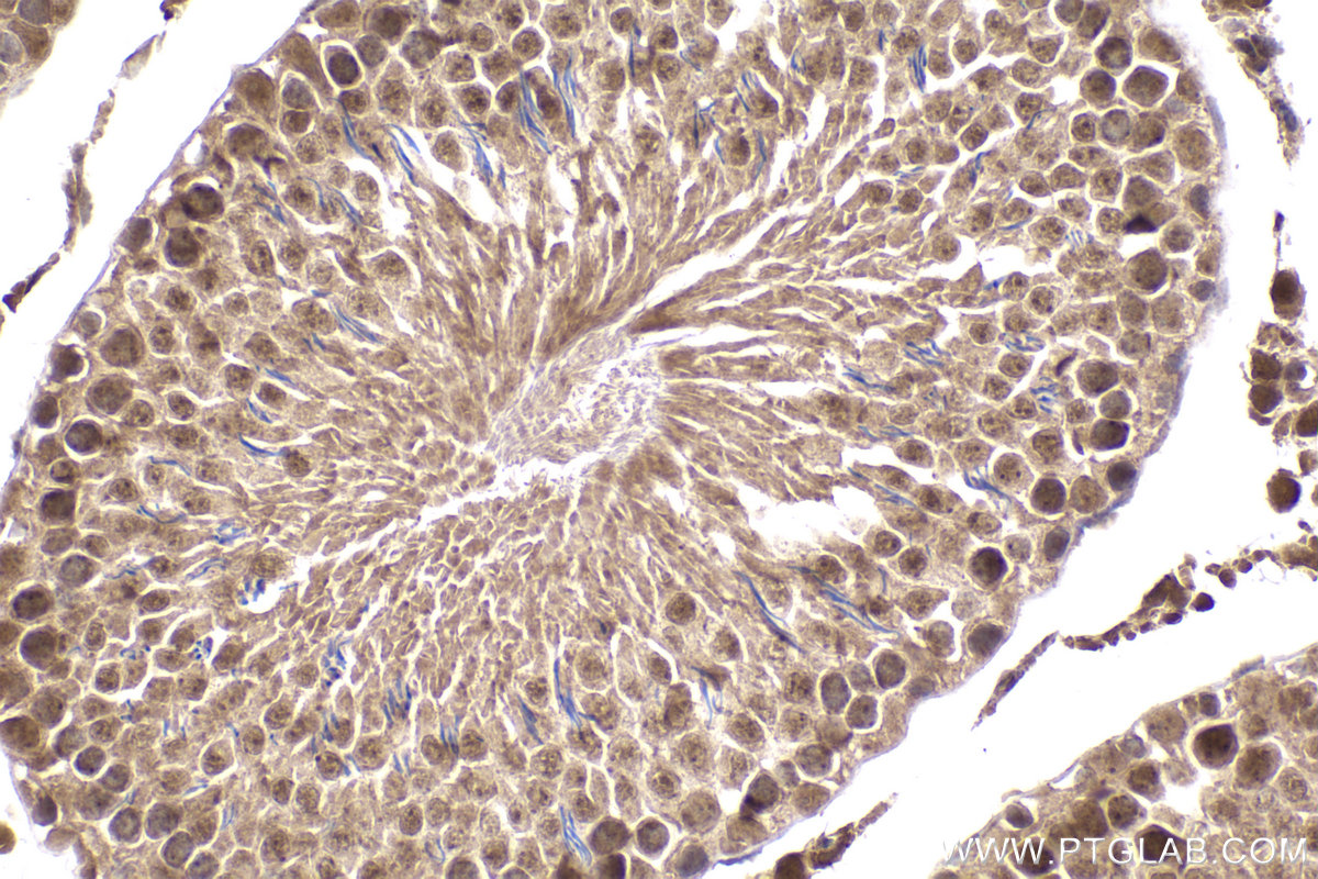 Immunohistochemical analysis of paraffin-embedded rat testis tissue slide using KHC2282 (PIP4K2A IHC Kit).