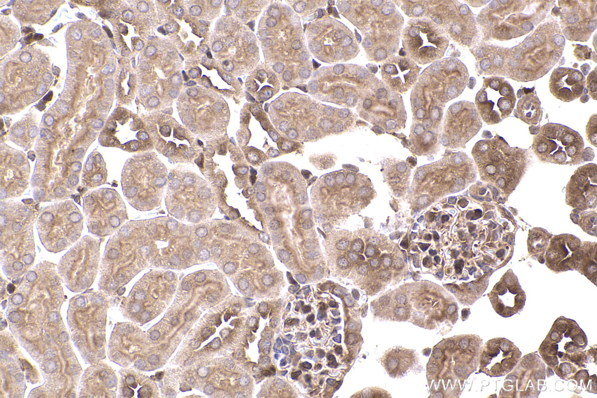 Immunohistochemical analysis of paraffin-embedded mouse kidney tissue slide using KHC2363 (PIP4K2B IHC Kit).