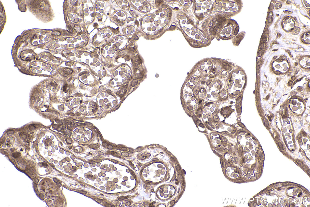 Immunohistochemical analysis of paraffin-embedded human placenta tissue slide using KHC2363 (PIP4K2B IHC Kit).