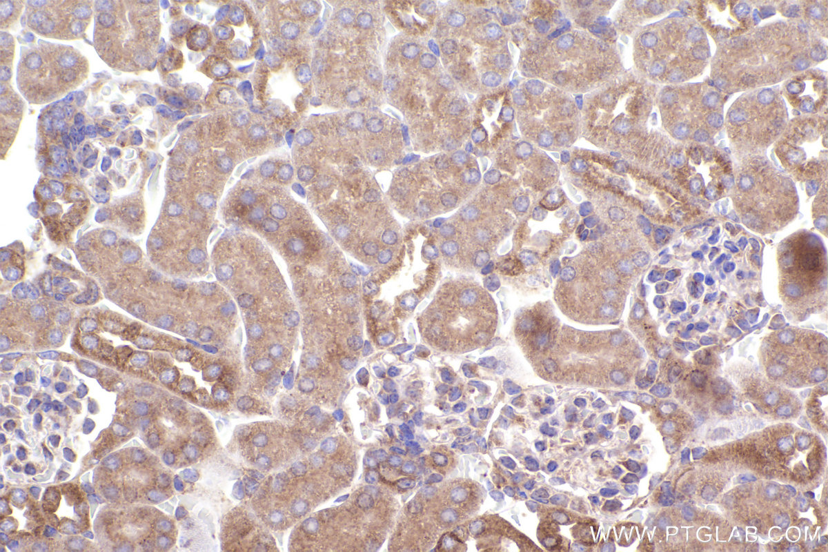 Immunohistochemical analysis of paraffin-embedded mouse kidney tissue slide using KHC2376 (PKD1 IHC Kit).