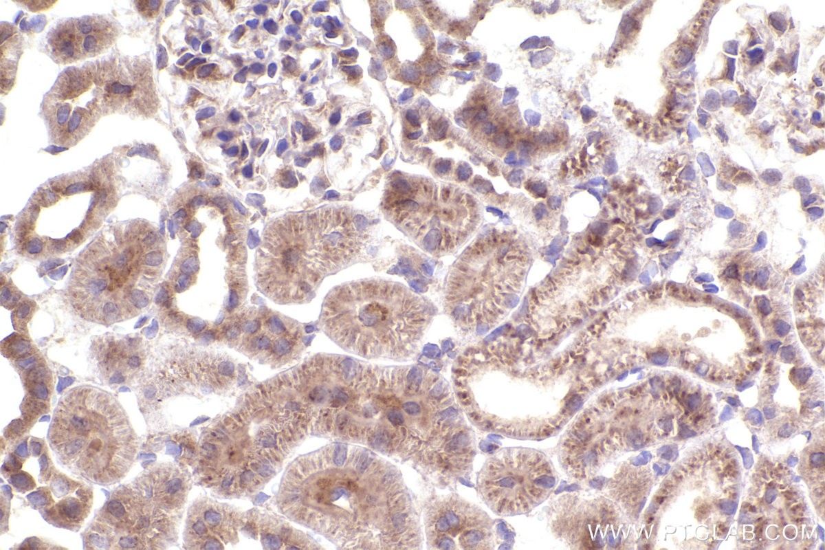 Immunohistochemical analysis of paraffin-embedded rat kidney tissue slide using KHC2376 (PKD1 IHC Kit).