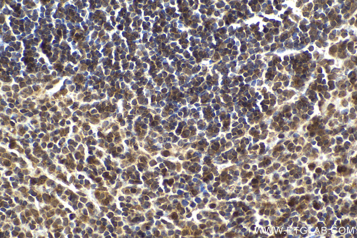 Immunohistochemical analysis of paraffin-embedded mouse spleen tissue slide using KHC2195 (PLCG2 IHC Kit).