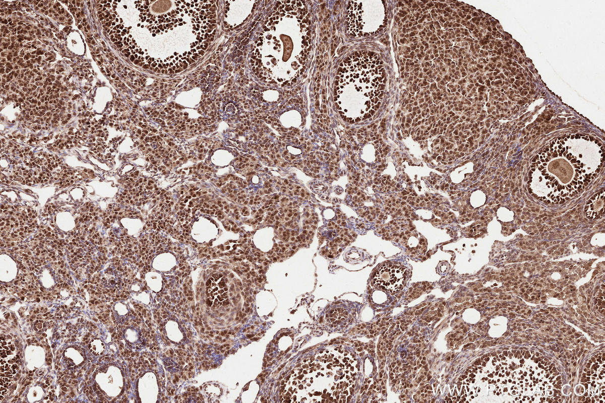 Immunohistochemical analysis of paraffin-embedded mouse ovary tissue slide using KHC2529 (PLK5P IHC Kit).