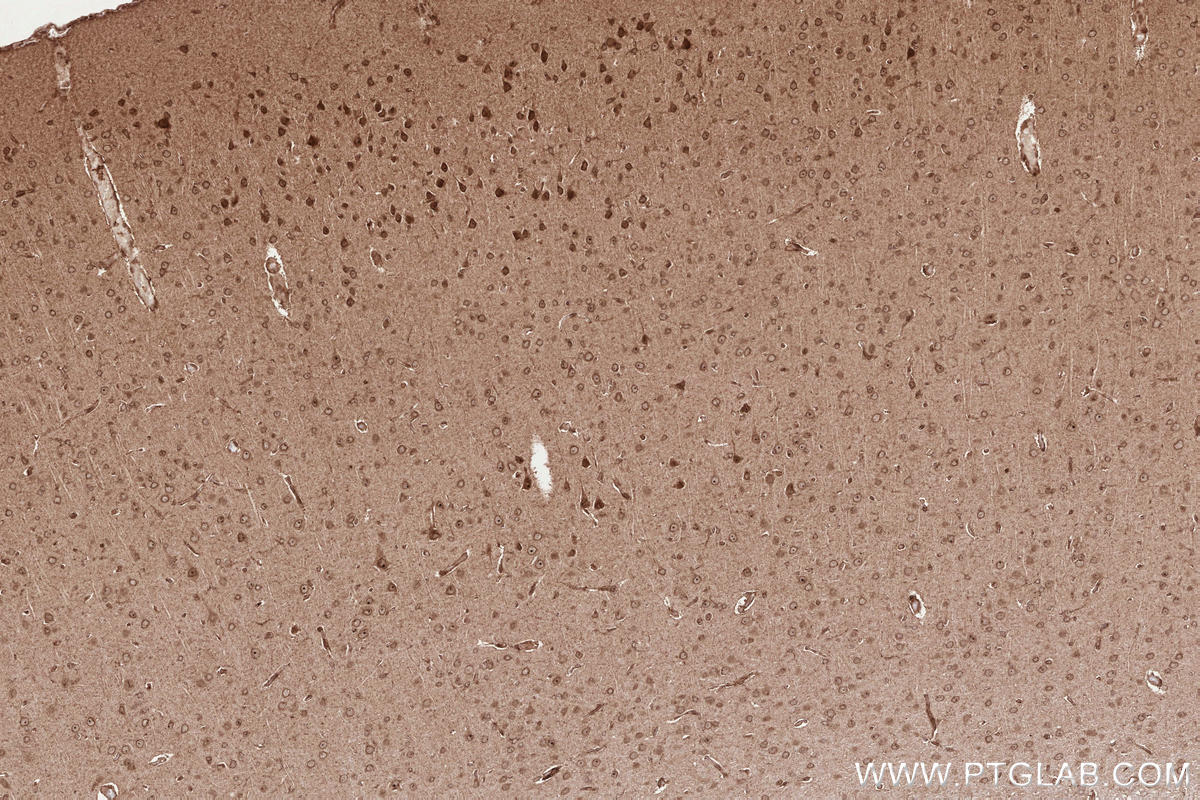 Immunohistochemical analysis of paraffin-embedded rat brain tissue slide using KHC2529 (PLK5P IHC Kit).