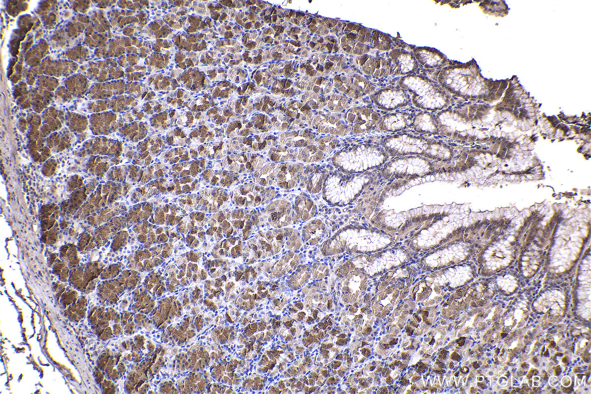 Immunohistochemical analysis of paraffin-embedded human stomach tissue slide using KHC2254 (PPP1CC IHC Kit).