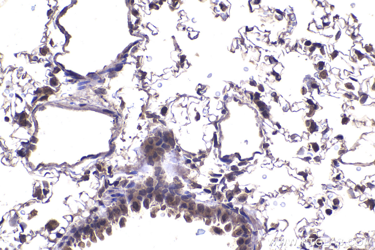 Immunohistochemical analysis of paraffin-embedded rat lung tissue slide using KHC2254 (PPP1CC IHC Kit).