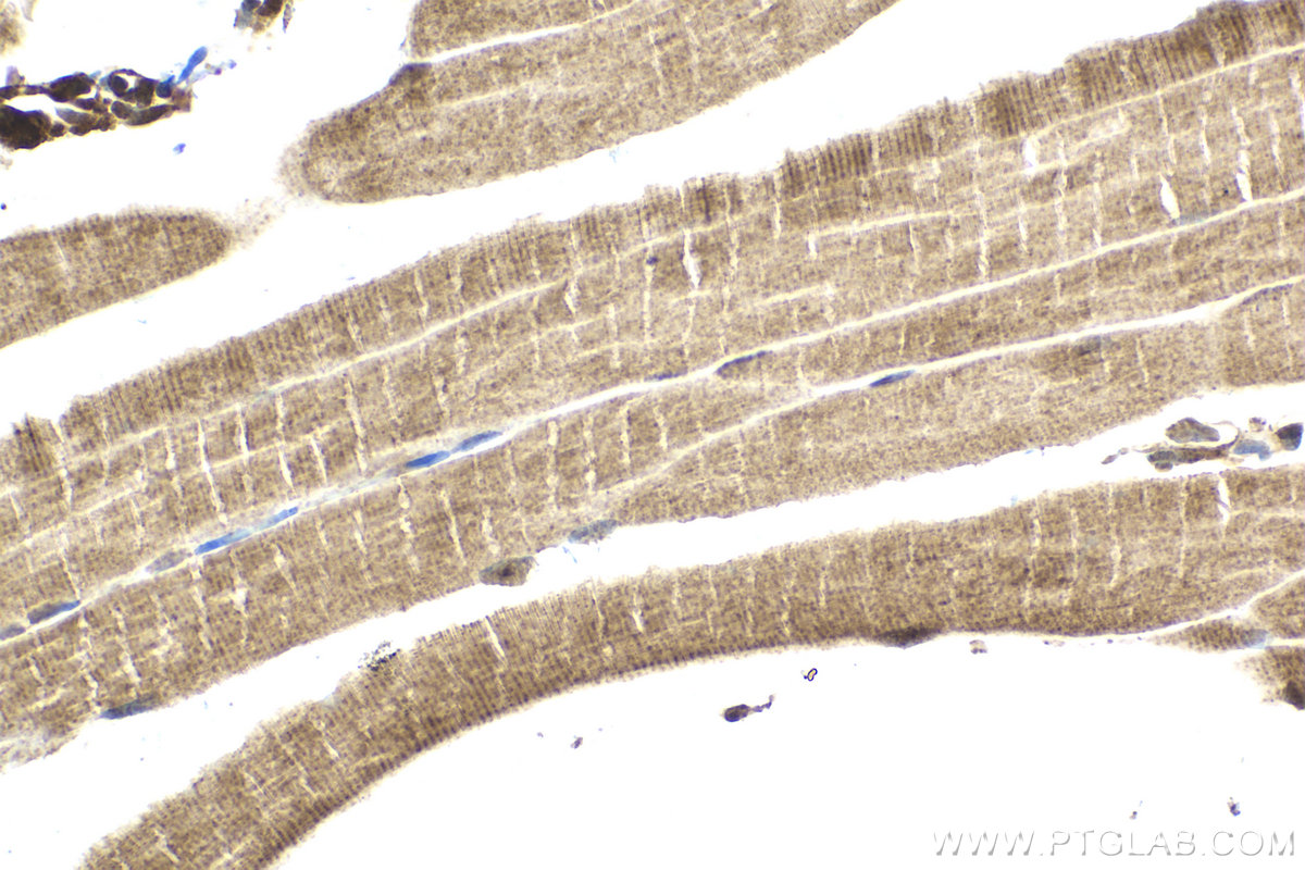 Immunohistochemical analysis of paraffin-embedded mouse skeletal muscle tissue slide using KHC2121 (PPP1R15A/GADD34 IHC Kit).