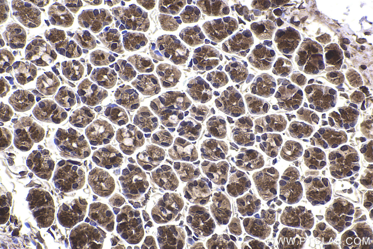 Immunohistochemical analysis of paraffin-embedded mouse stomach tissue slide using KHC2362 (PPP2CA IHC Kit).