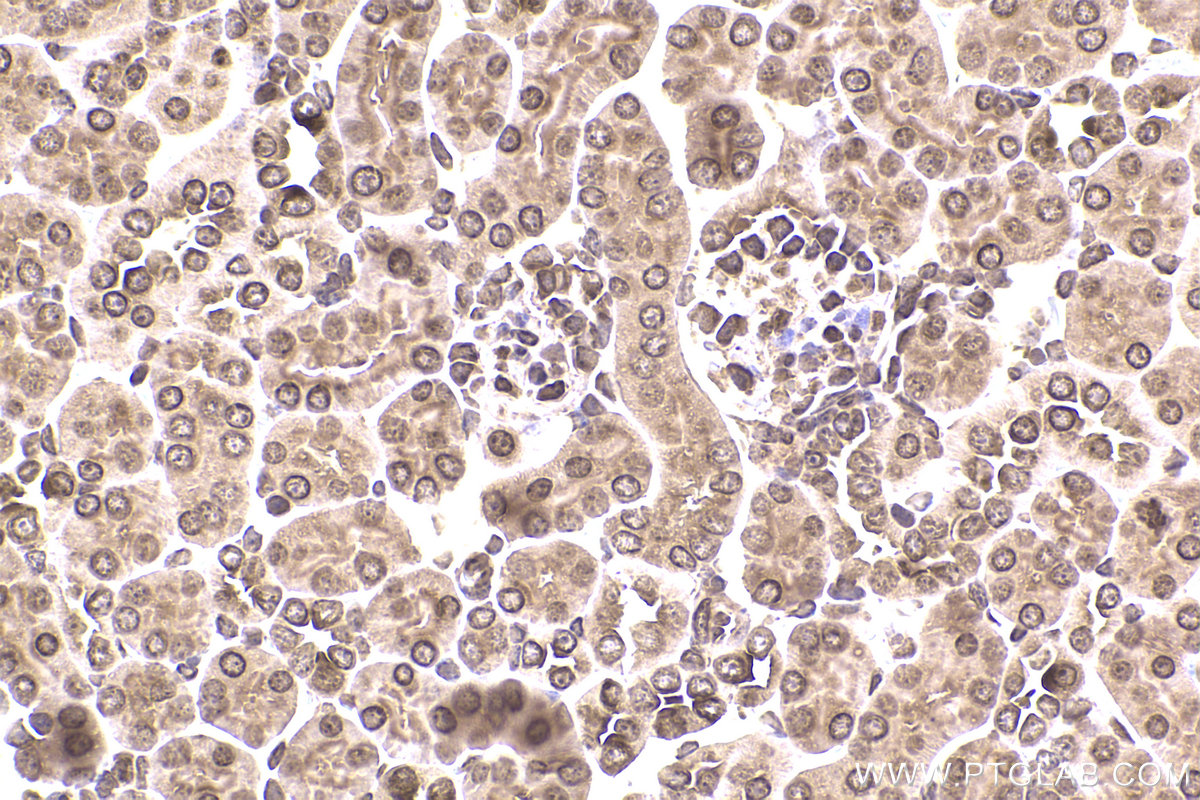 Immunohistochemical analysis of paraffin-embedded mouse kidney tissue slide using KHC2362 (PPP2CA IHC Kit).