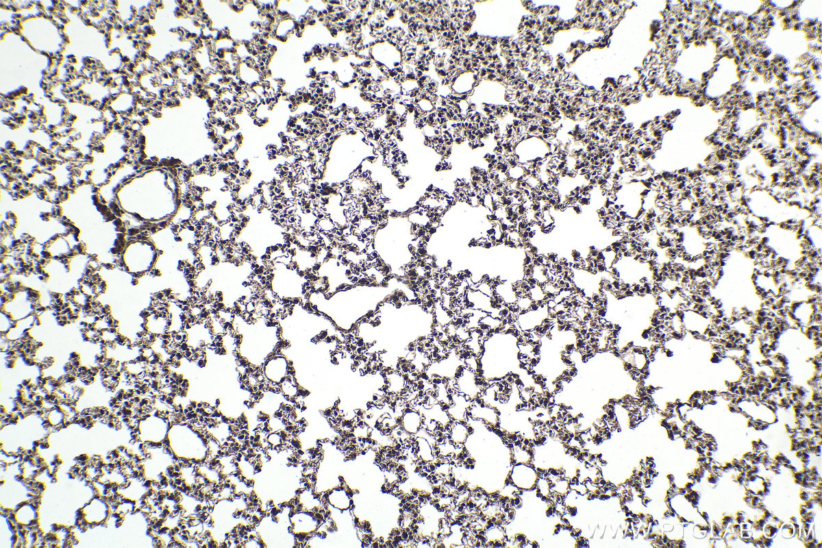Immunohistochemical analysis of paraffin-embedded mouse lung tissue slide using KHC2093 (PRKAB2 IHC Kit).