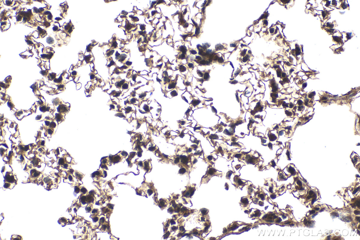 Immunohistochemical analysis of paraffin-embedded mouse lung tissue slide using KHC2093 (PRKAB2 IHC Kit).