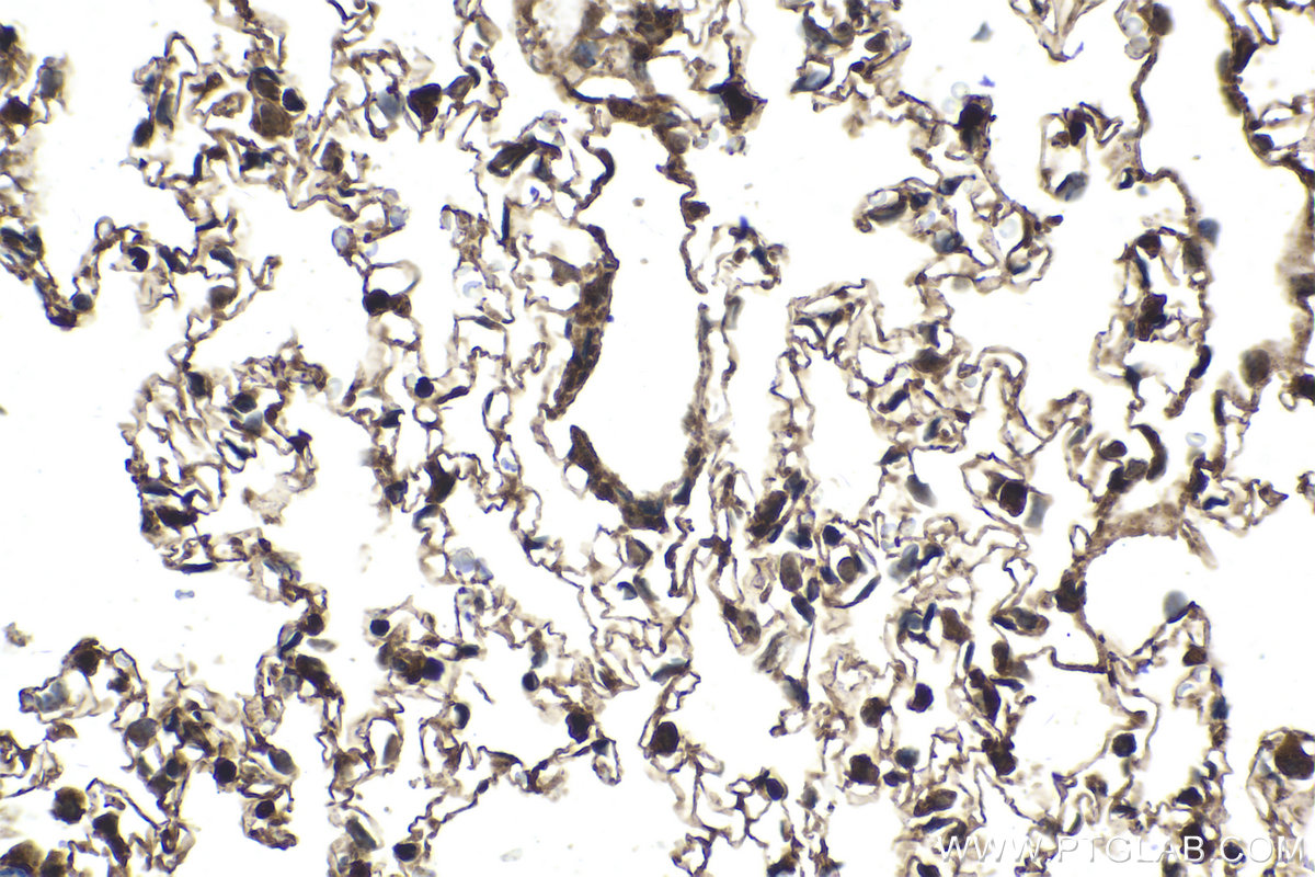 Immunohistochemical analysis of paraffin-embedded rat lung tissue slide using KHC2093 (PRKAB2 IHC Kit).