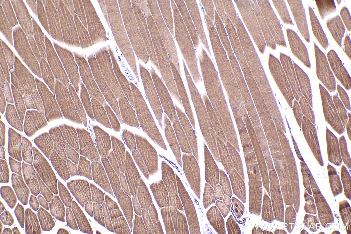 Immunohistochemical analysis of paraffin-embedded mouse skeletal muscle tissue slide using KHC2392 (PRKCQ IHC Kit).