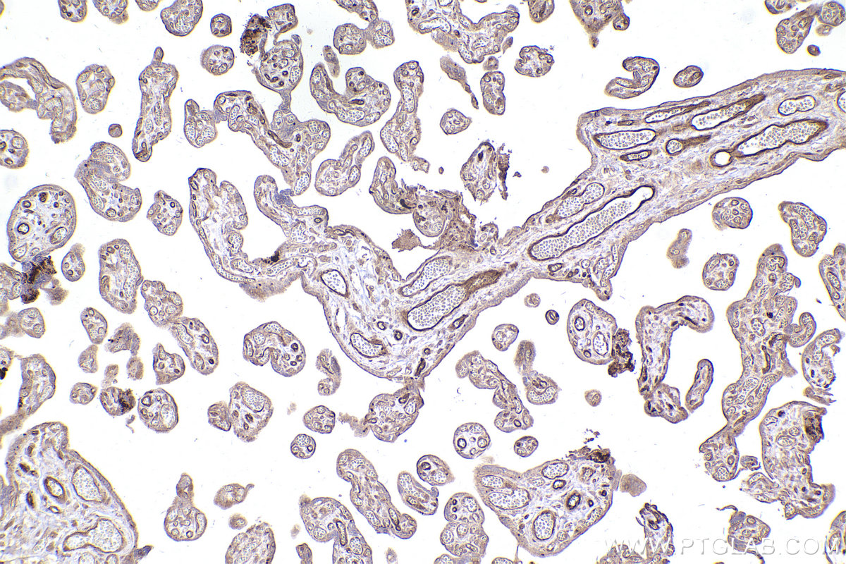 Immunohistochemical analysis of paraffin-embedded human placenta tissue slide using KHC2481 (PRKD1 IHC Kit).