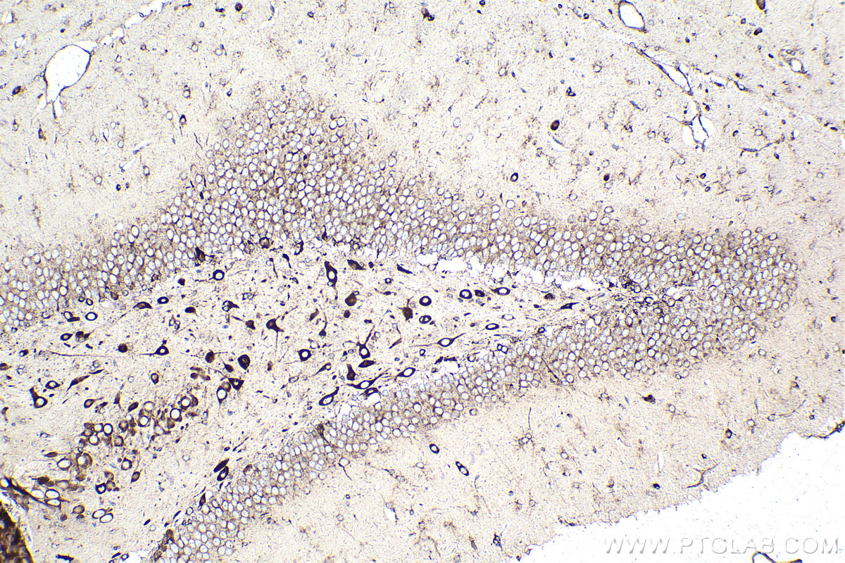 Immunohistochemical analysis of paraffin-embedded rat brain tissue slide using KHC2115 (PRKRA IHC Kit).