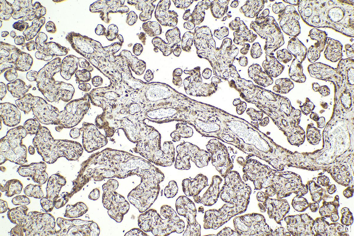 Immunohistochemical analysis of paraffin-embedded human placenta tissue slide using KHC2042 (PSMD12 IHC Kit).