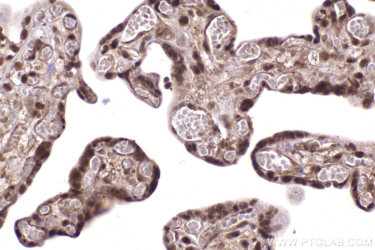 Immunohistochemical analysis of paraffin-embedded human placenta tissue slide using KHC2423 (PSMD2 IHC Kit).