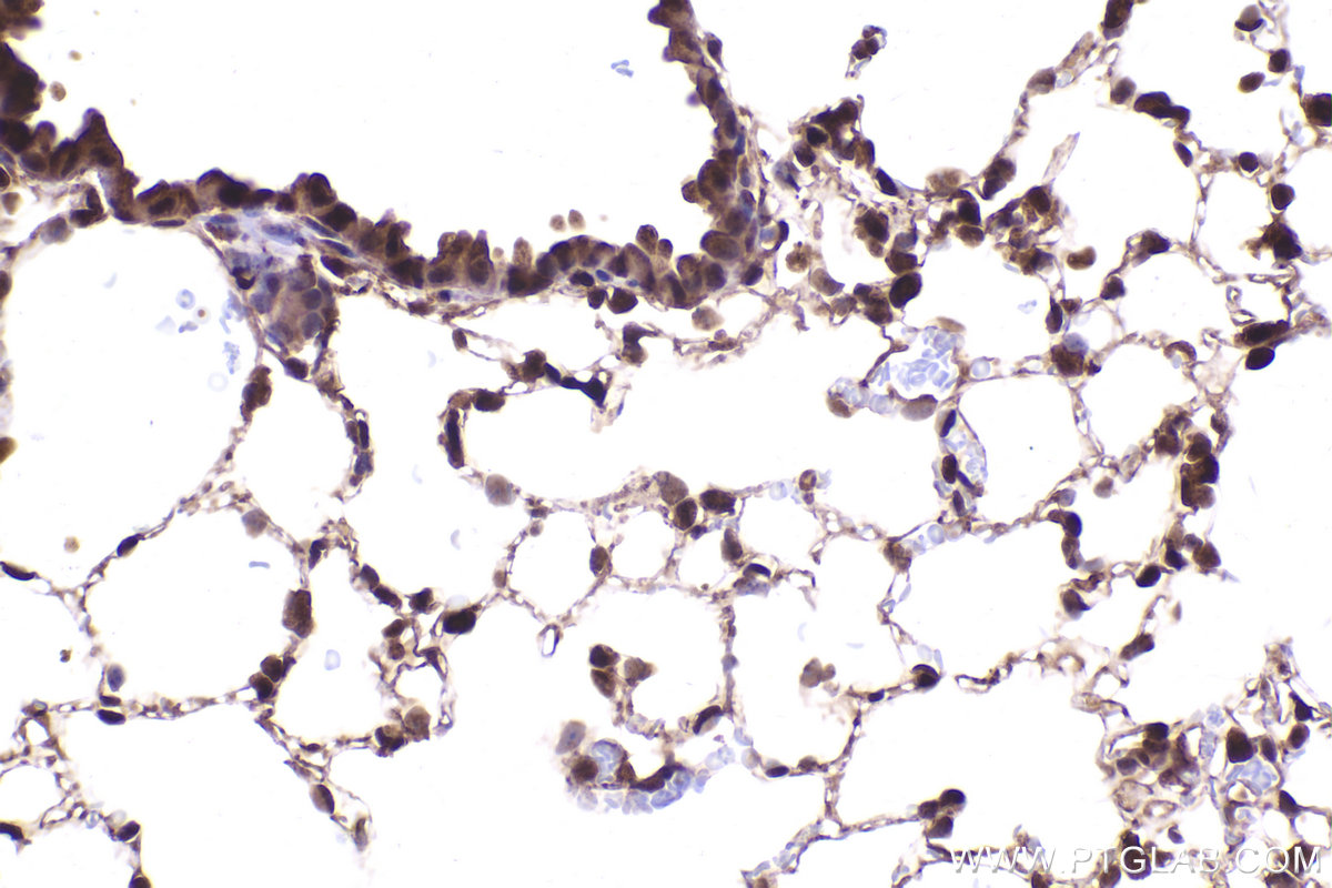 Immunohistochemical analysis of paraffin-embedded mouse lung tissue slide using KHC2423 (PSMD2 IHC Kit).