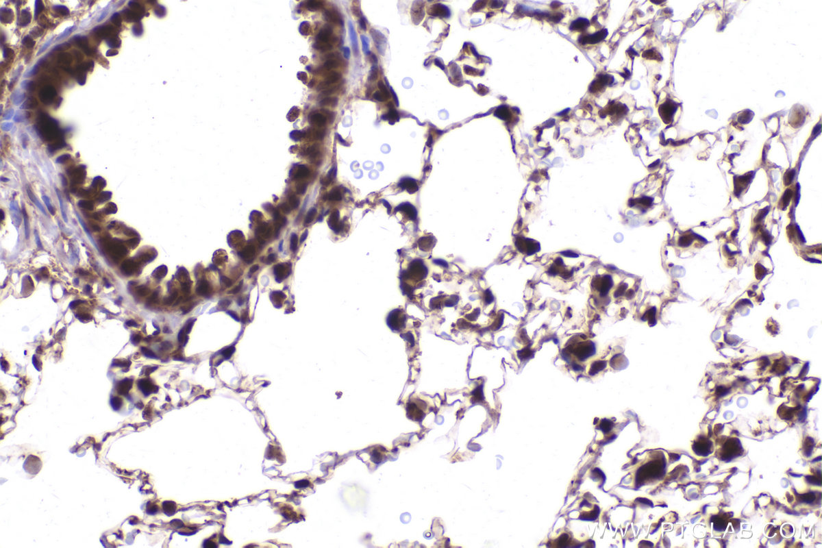 Immunohistochemical analysis of paraffin-embedded rat lung tissue slide using KHC2423 (PSMD2 IHC Kit).