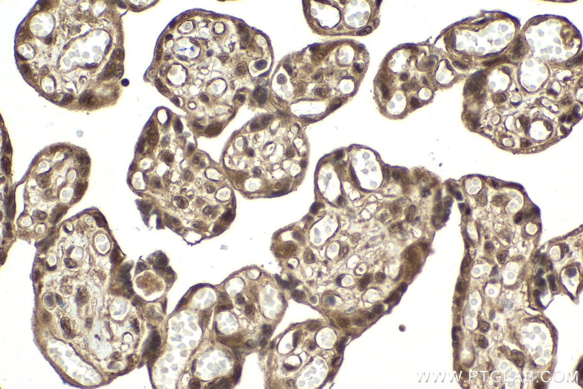 Immunohistochemical analysis of paraffin-embedded human placenta tissue slide using KHC2075 (PSMD3 IHC Kit).