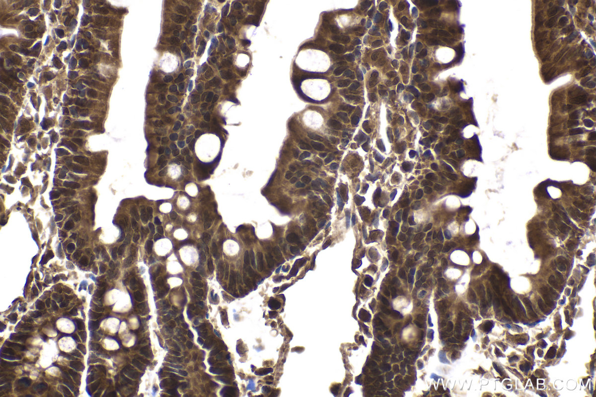 Immunohistochemical analysis of paraffin-embedded rat small intestine tissue slide using KHC2075 (PSMD3 IHC Kit).