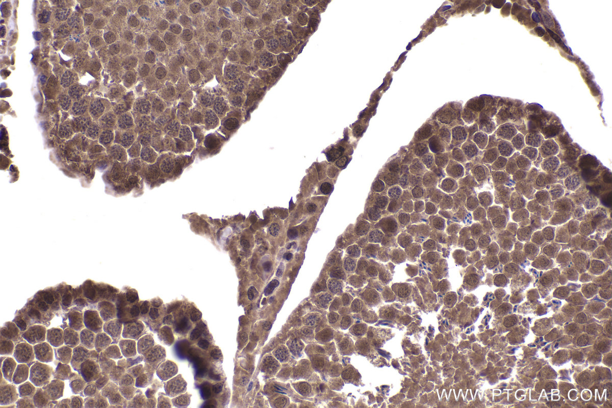 Immunohistochemical analysis of paraffin-embedded rat testis tissue slide using KHC2328 (PSMD4 IHC Kit).